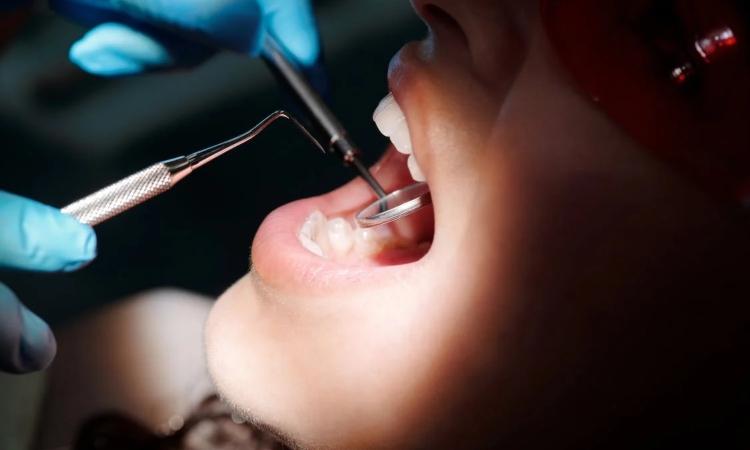Marcatura laser e industria dentale